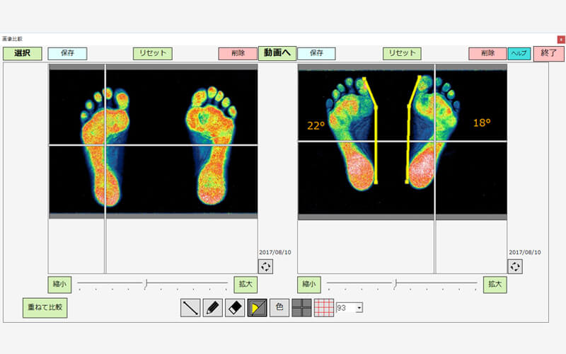 lower extremity biomechanics