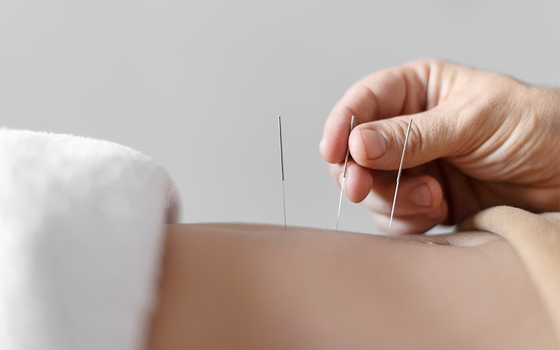 Receipt Helper System for Acupuncturists